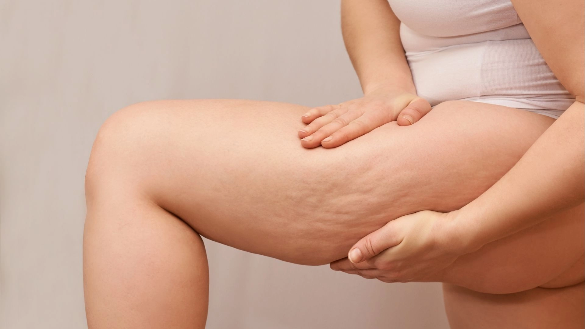 女生為什麼有橘皮？橘皮怎麼消除?？醫美改善＋日常對策一次看