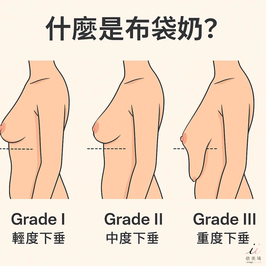 什麼是布袋奶