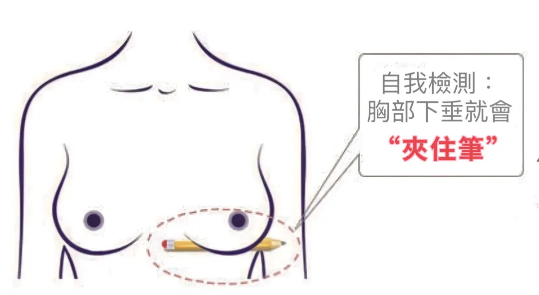 自我檢測~您的胸部下垂嗎?